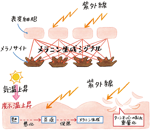 肌図のイラストです。